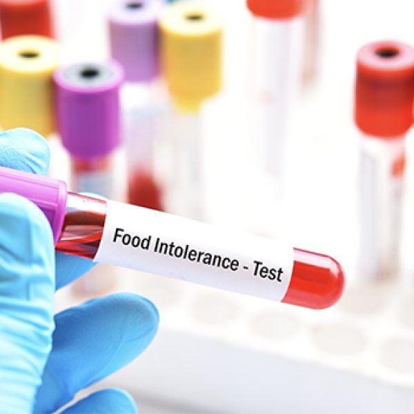 Food Intolerance Test