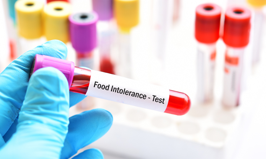 Test,Tube,With,Blood,Sample,For,Food,Intolerance,Test